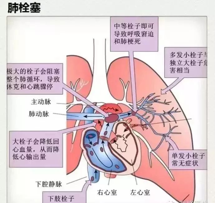 双氧水给土壤消毒,双氧水给物体消毒