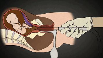 男用避孕药通过试验,网友:叫刘阳打针,半藏森林你不用吃药了