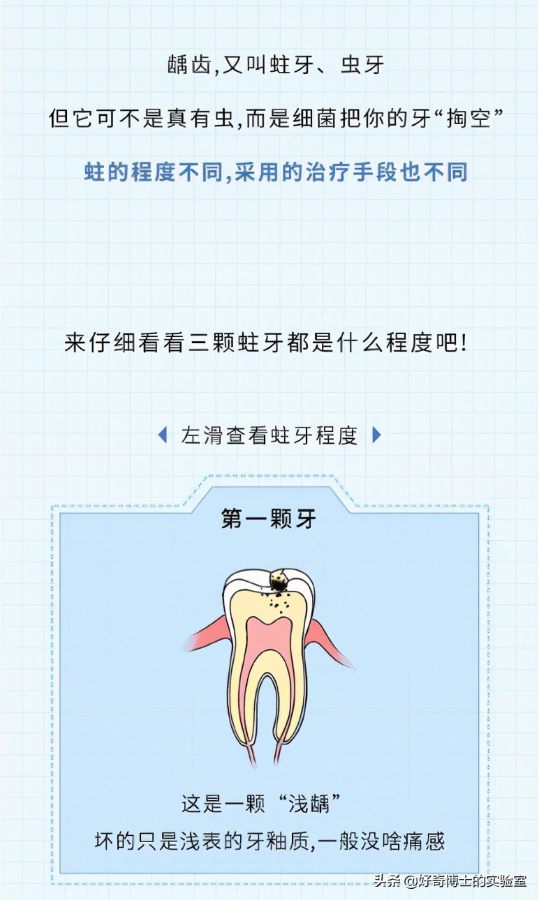 治牙到底有多恐怖,治牙有多痛苦
