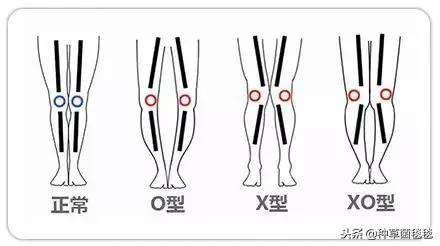如何才能有一双长腿,如何拥有长腿