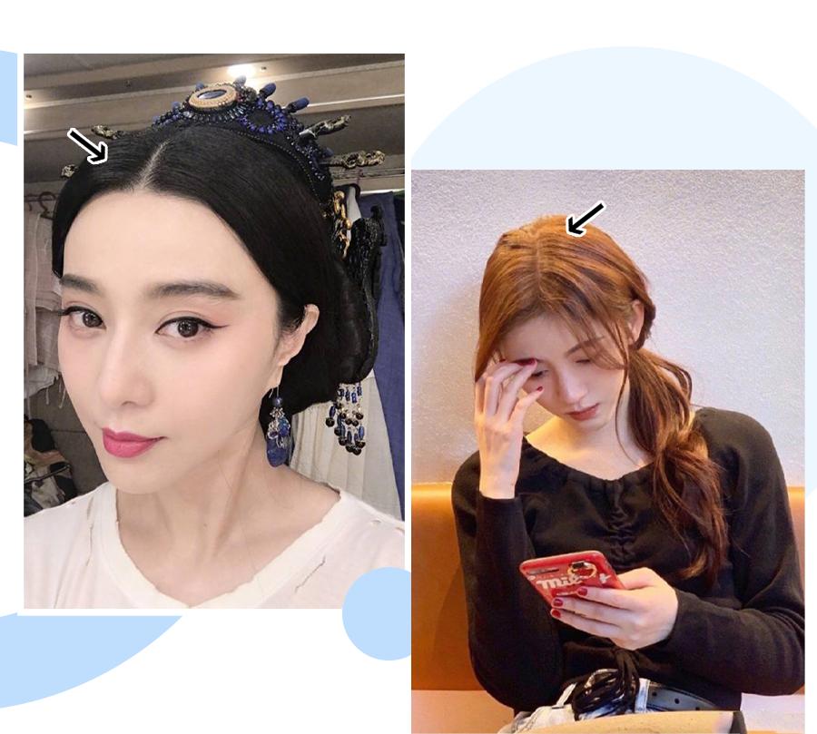 鞠婧祎全身造假,鞠婧祎头皮都整了吗