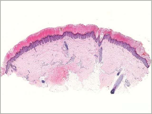 皮肤很痒不能挠怎么缓解,皮肤瘙痒的受不了怎么办
