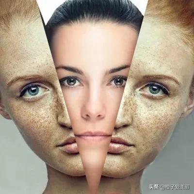 淡斑三天见效的方法,淡斑祛斑最好的护肤品十大排行