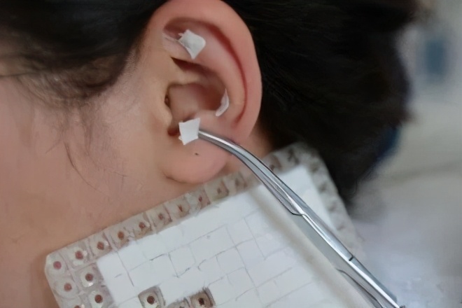 反酸？烧心？—关于“胃食管反流病”的那些事儿