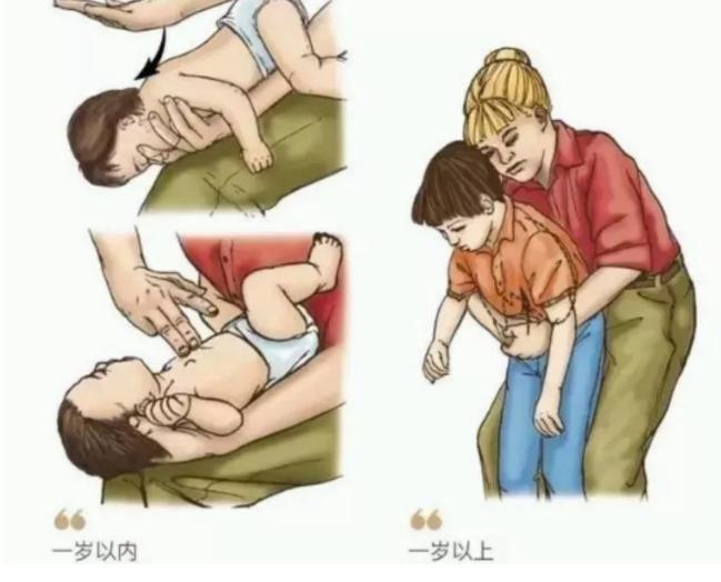 2岁宝宝误吞异物会不停咳嗽吗,宝宝误吞异物如何处理