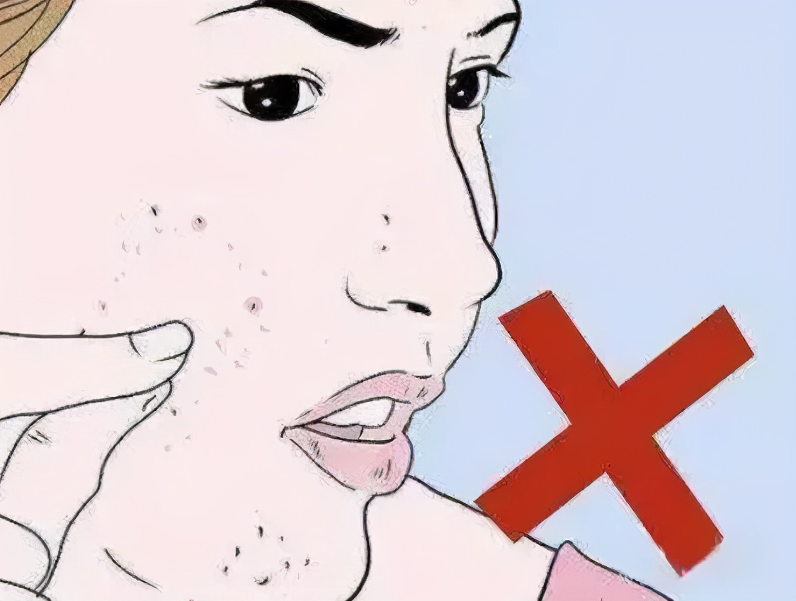 有哪些祛痘痘和祛痘印的产品,怎样祛痘痘和痘印最快最有效的