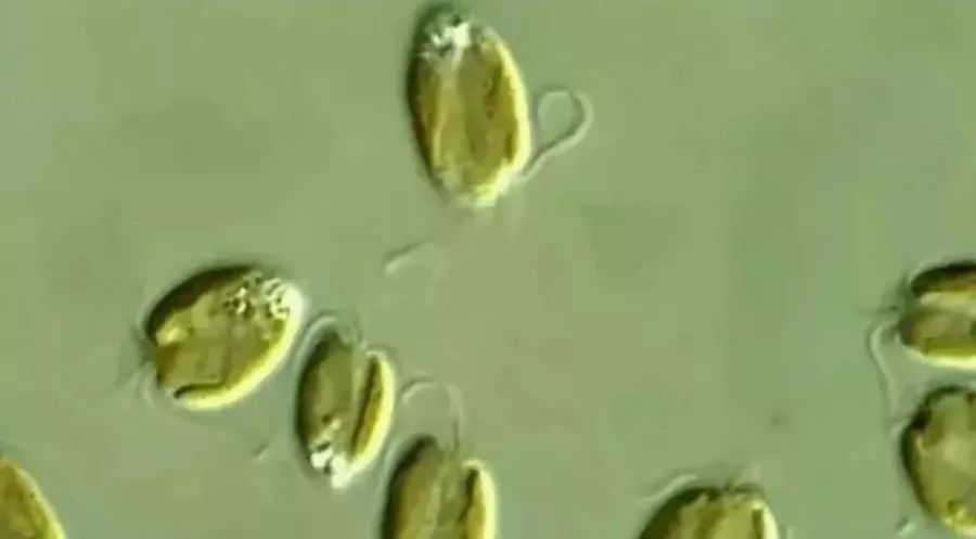 水中常见的绿藻,列举哪些常见藻类是绿藻