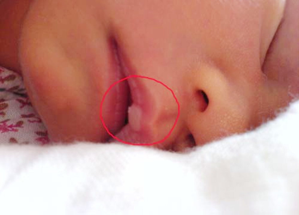 秋季宝宝护肤小技巧你get到了吗,宝宝秋季皮肤干燥用什么护肤品好