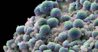 梅毒中老年人,七八十岁的老人感染的梅毒