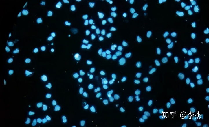 细胞培养出现链球菌污染怎么办,细胞培养如何应对支原体污染