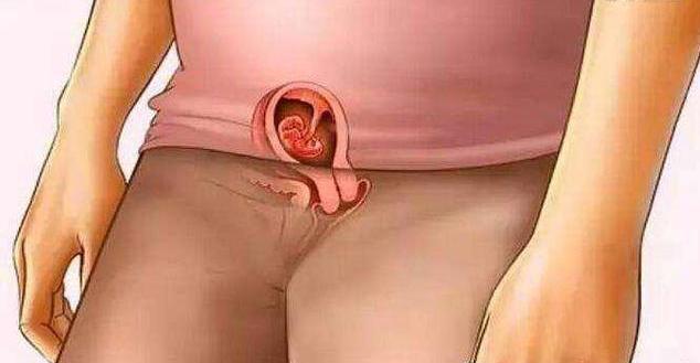 怀胎十月胎儿位置图,怀胎十月婴儿发育全过程