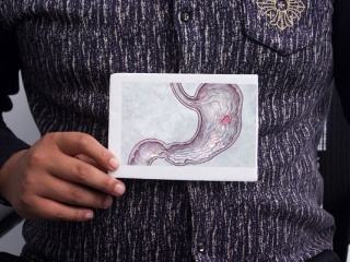 300000000肠胃疾病患者,都忽略了中医的外治技术