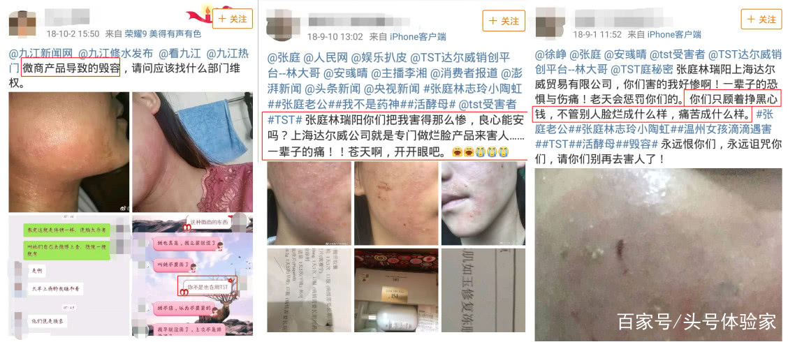 吸血面膜微商,微商面膜有前景吗