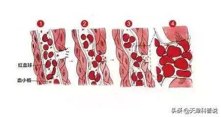 伤口结痂后特别特别的痒是为什么,结痂的地方奇痒难忍为什么
