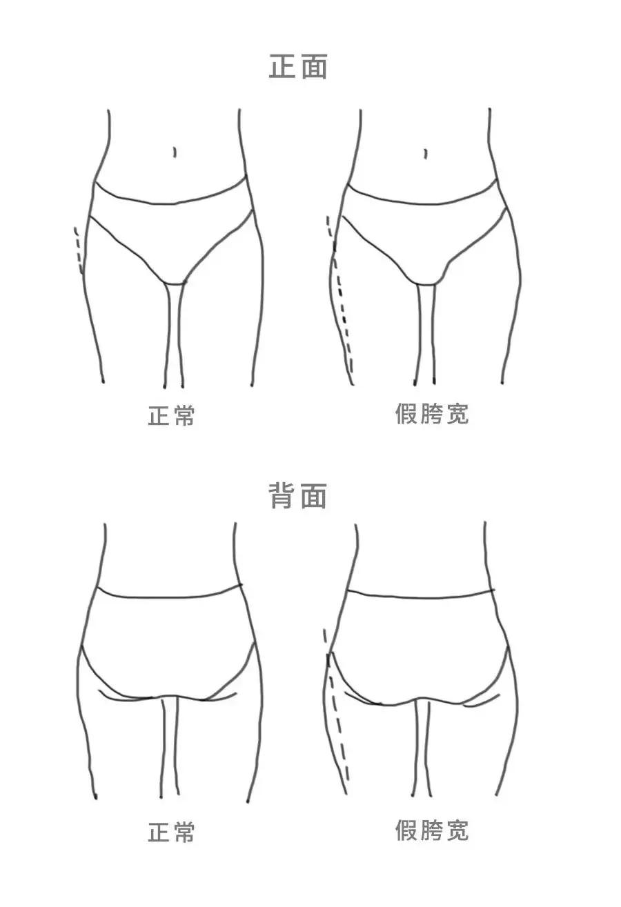 angelababy腿以前粗吗,angelababy腿短