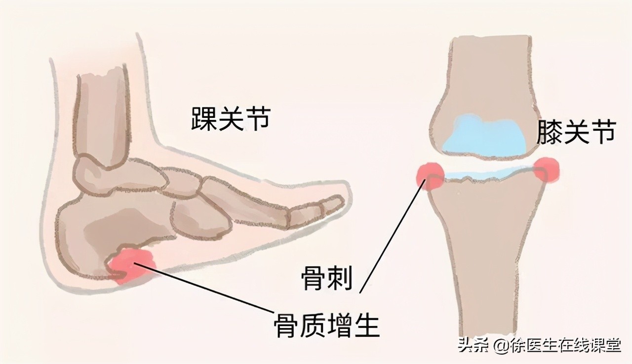 老年人脚底板疼怎么回事,老年人脚底板痛怎么回事怎么治