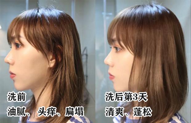 明星亲测力推同款洗发水,康王亲测