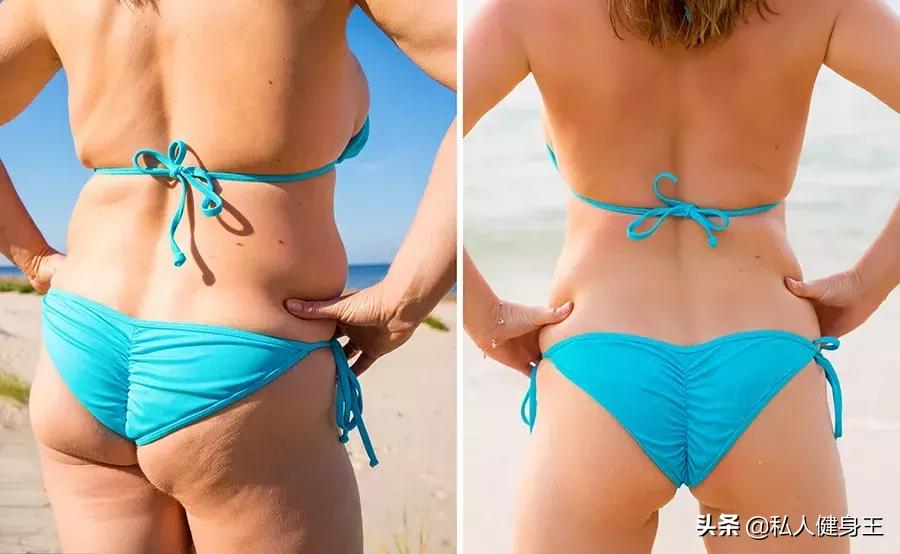 久坐怎么防止臀部扁平,长期久坐屁股凹陷怎么办