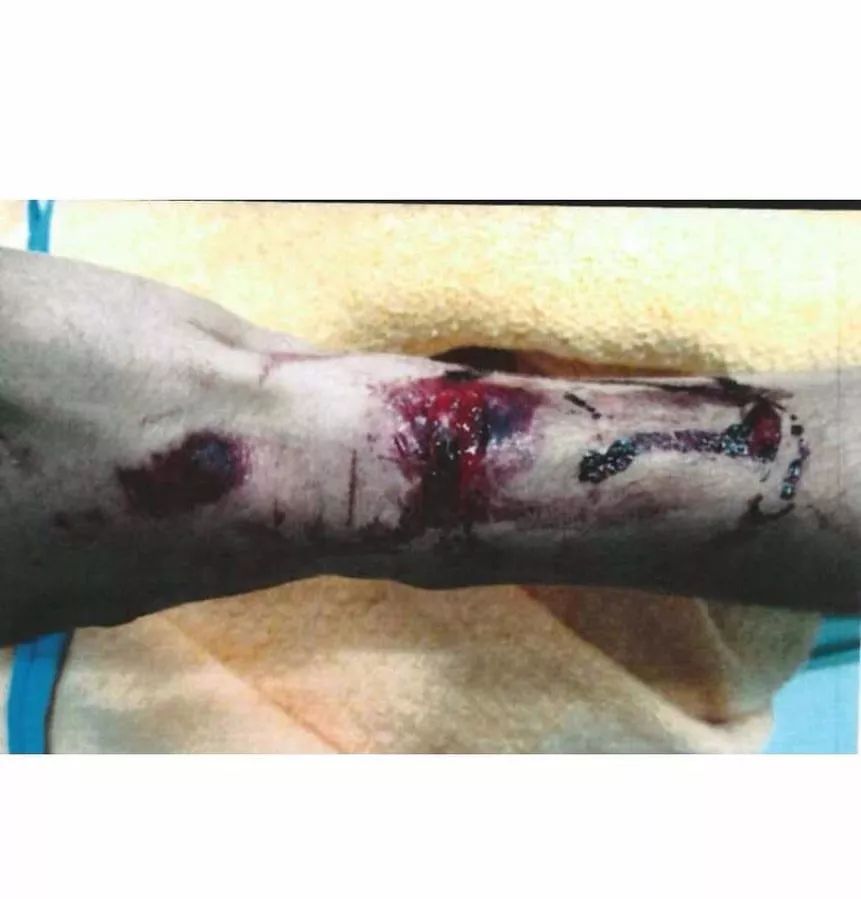 rocky指控,rocky最终判决结果