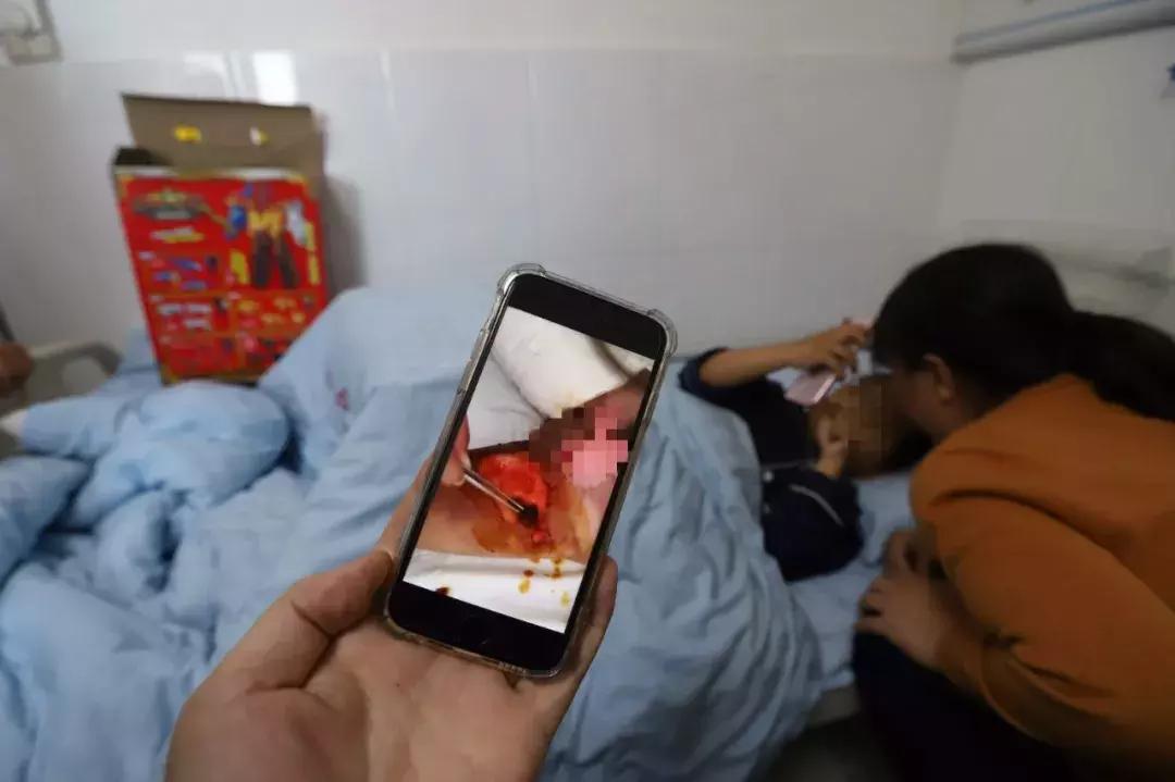 8岁男孩被泼开水后续,痛心七岁男童落水竟没人管