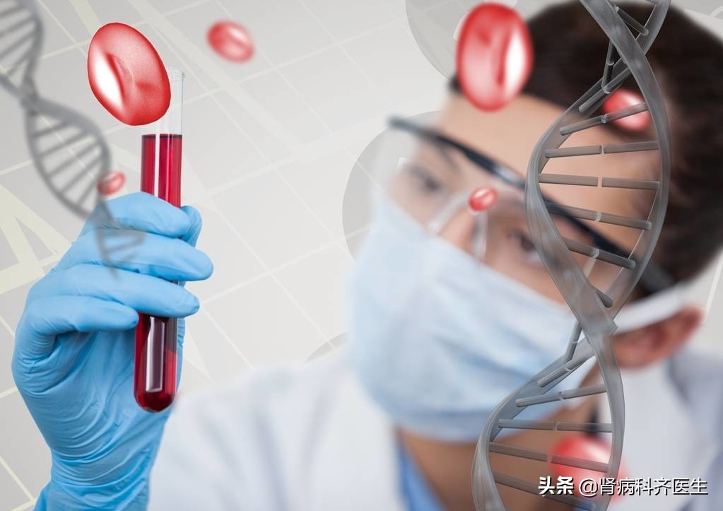 肾性血尿判断标准,血尿如何确认是肾炎还是结石