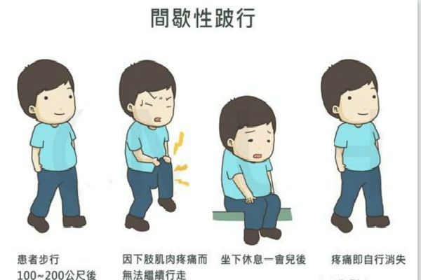 腰突压迫神经导致脚疼怎么办,脚痛无法形容的痛