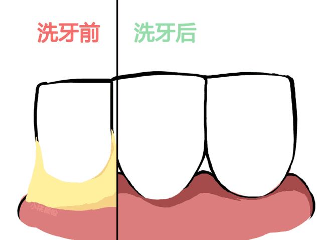 情人节不想开口牙黄很丢人？这招能让你牙白有气质！