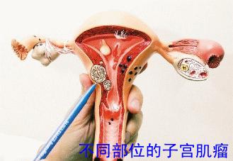 子宫一旦切除就会不像女人？也不能同房了？