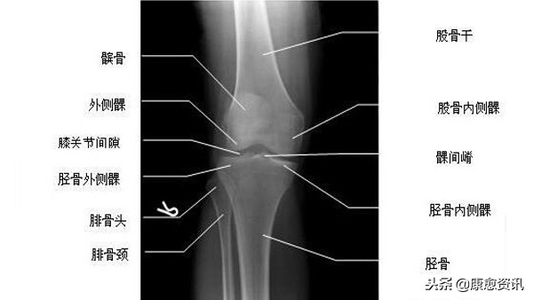 膝关节术后康复,膝关节术后康复手法视频教程