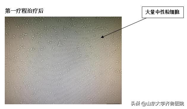 中国首创载药囊泡治疗,山东齐鲁医院自己研制的药