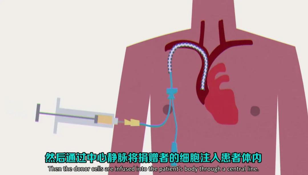 白血病骨髓肿瘤能治好吗怎么治疗,慢性骨髓白血病是怎么引起的