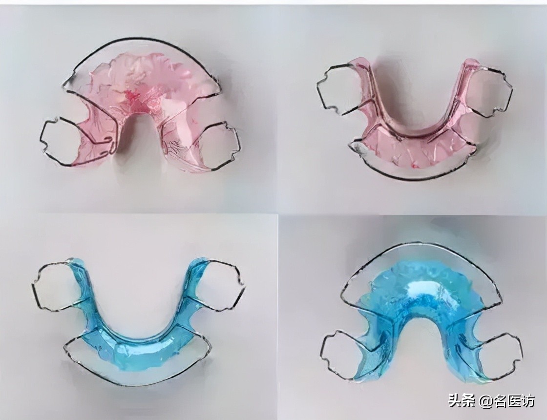 儿童牙齿矫正后要终身戴保持器吗,牙齿矫正戴保持器后还需要复诊吗