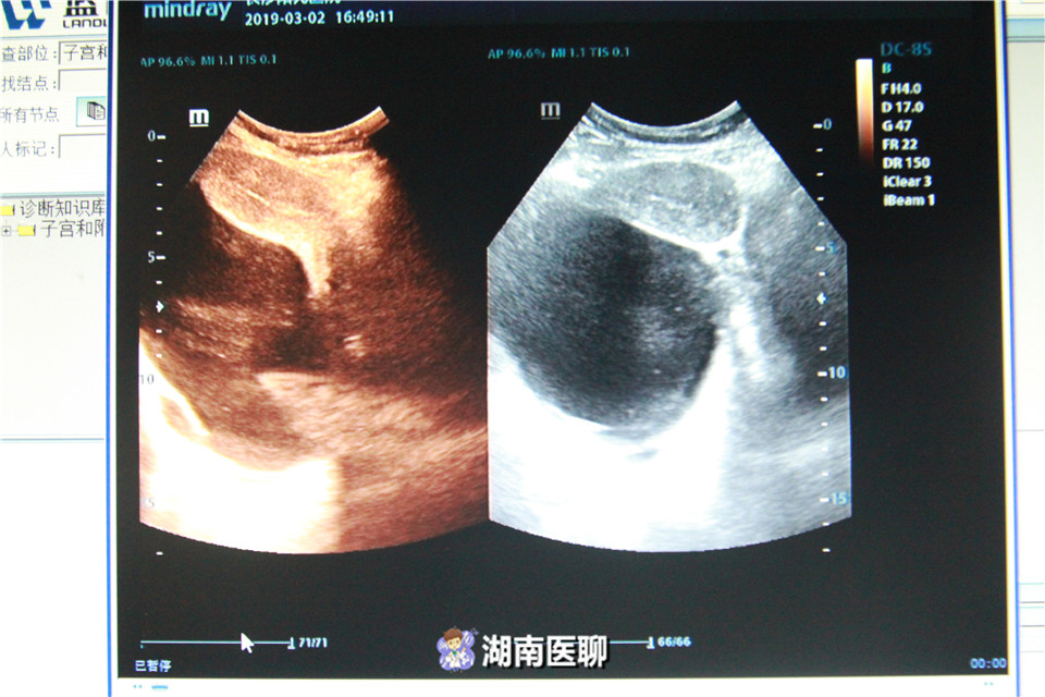 女子备孕2年未能怀上,备孕一年未成功的女人