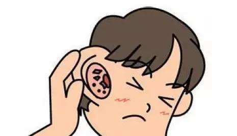 老年人神经性耳聋耳鸣能治愈吗,感冒后的神经性耳鸣能治愈吗