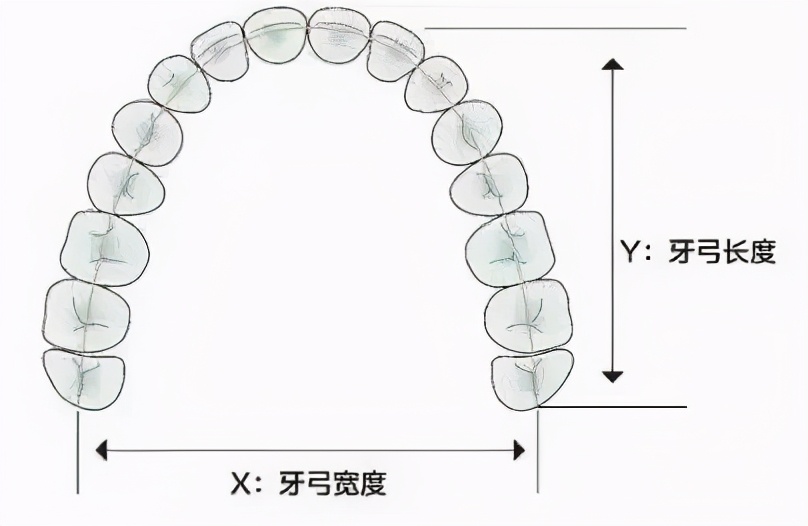 成年人牙齿矫正戴上牙套嘴巴变凸,扩弓会使脸型变大吗