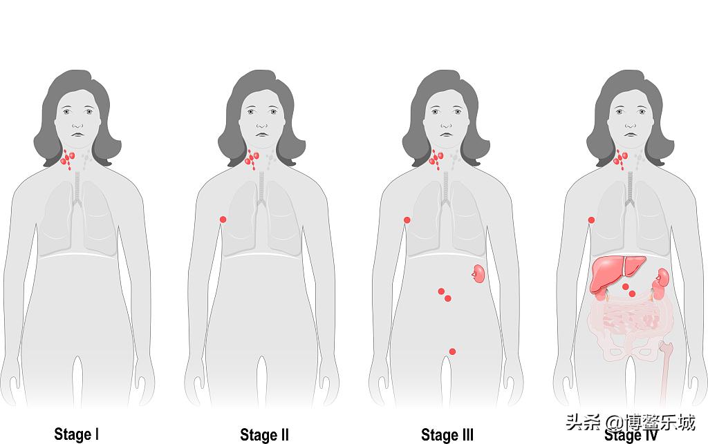 特药治癌成功案例,治癌特药