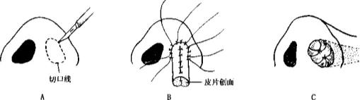 鼻道狭窄引起呼吸困难,先天性鼻道狭窄