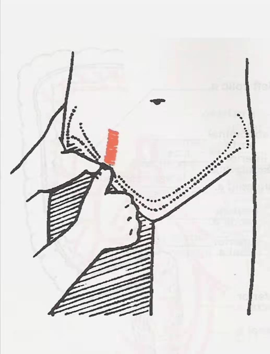 盘江总医院：家长们注意了！藏在幼儿衣物里的“隐形杀手”不容忽视