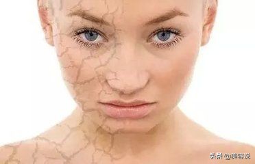 空调暖气干燥如何保湿,冬天空调房太干燥怎么办