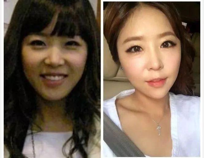 天后因队友吸du人气暴跌,公开承认整形却成蛇精下巴,瘦到脱相