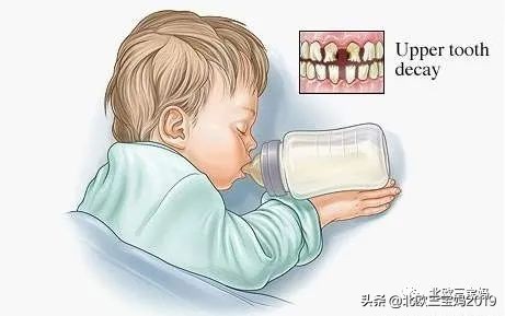 5岁小孩打全麻治蛀牙有影响吗,3岁孩子全麻风险大吗