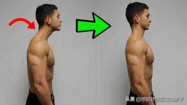 颈椎病和肥胖有关系么,脖子后面有堆肉是颈椎出问题了吗