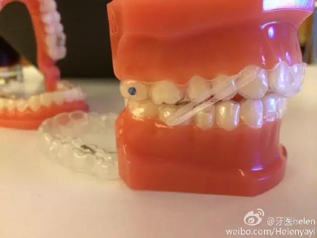 helen鐗欑涓績鍥剧墖,helen榻跨