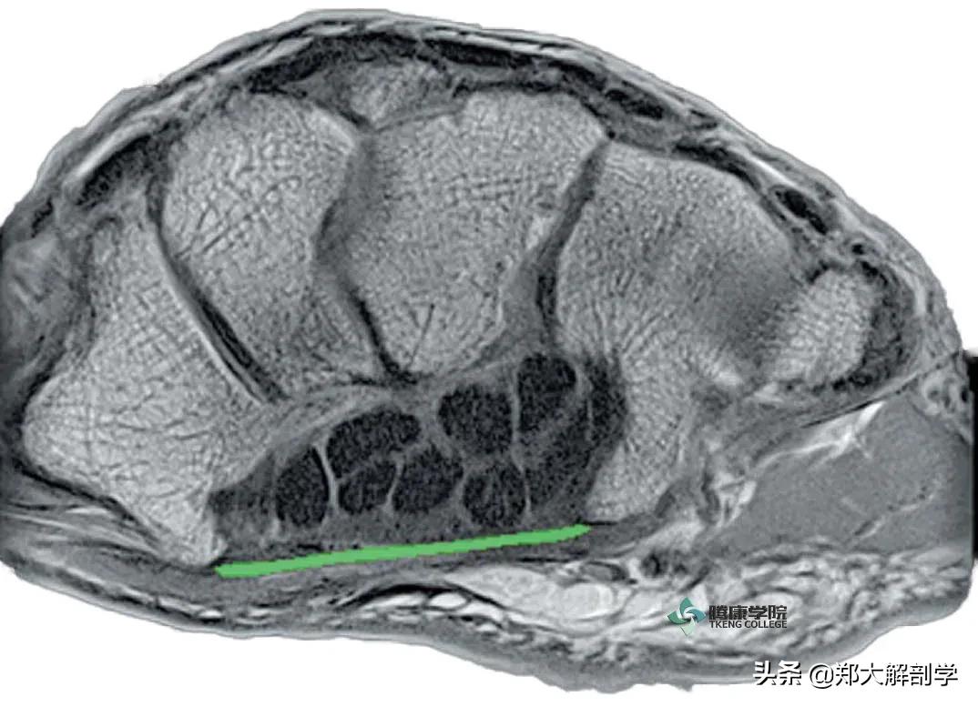 治疗手腕痛手法,手腕部突然疼痛是怎么回事
