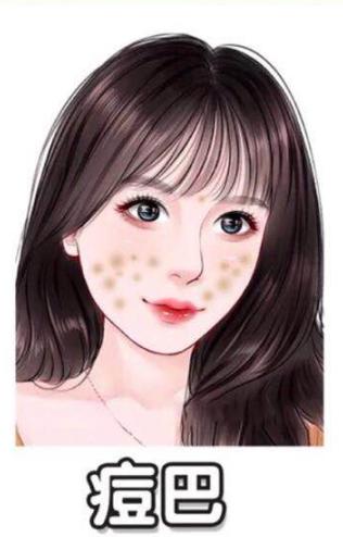 有哪些淡化痘印消灭痘痘的好习惯,一招教你淡化痘印