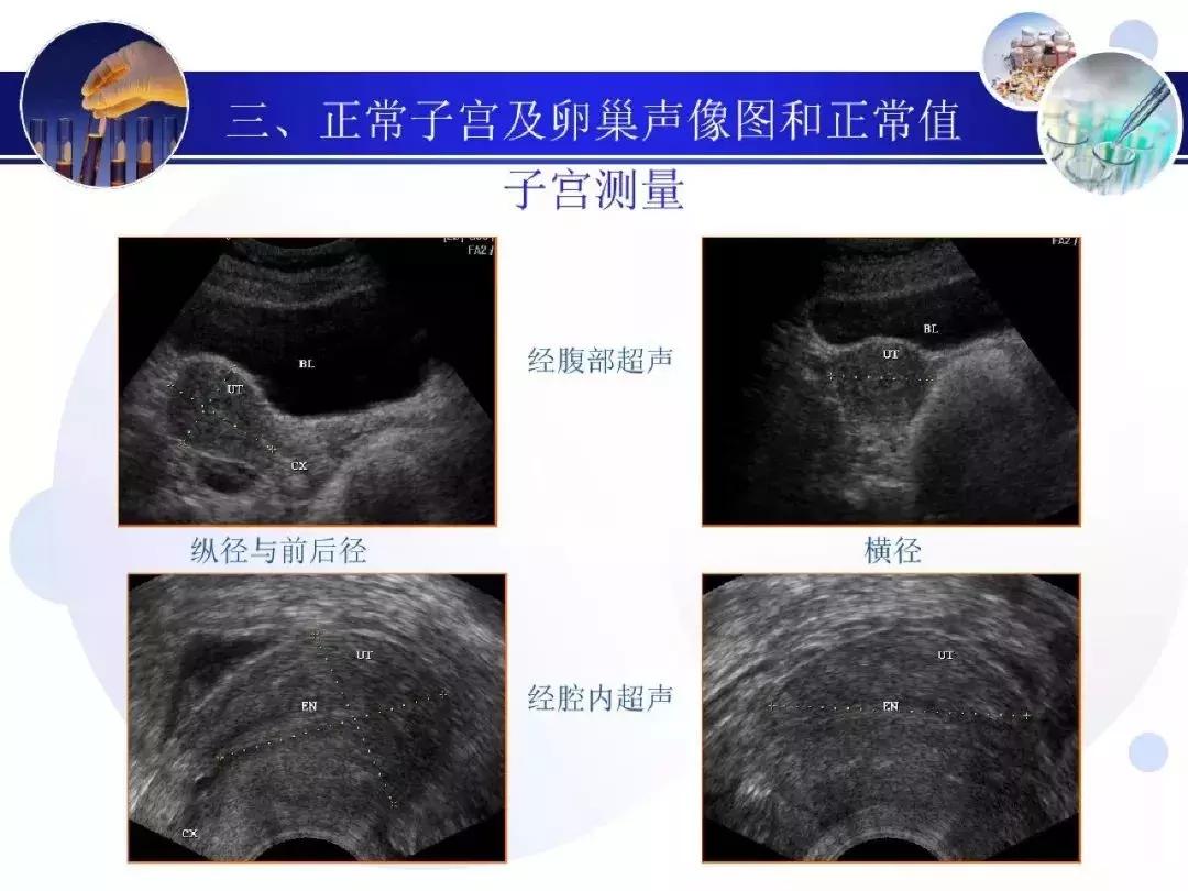 纯干货！子宫及附件解剖和超声诊断