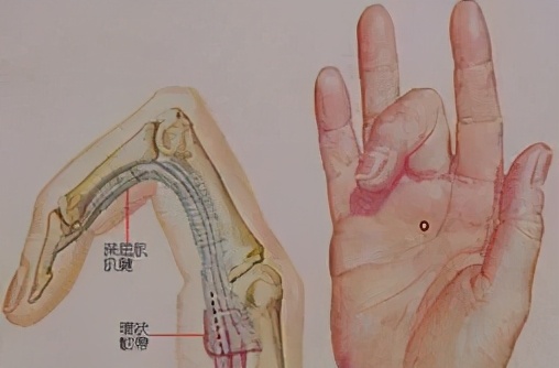 康复科冲击波效果好吗,康复科的冲击波是什么作用