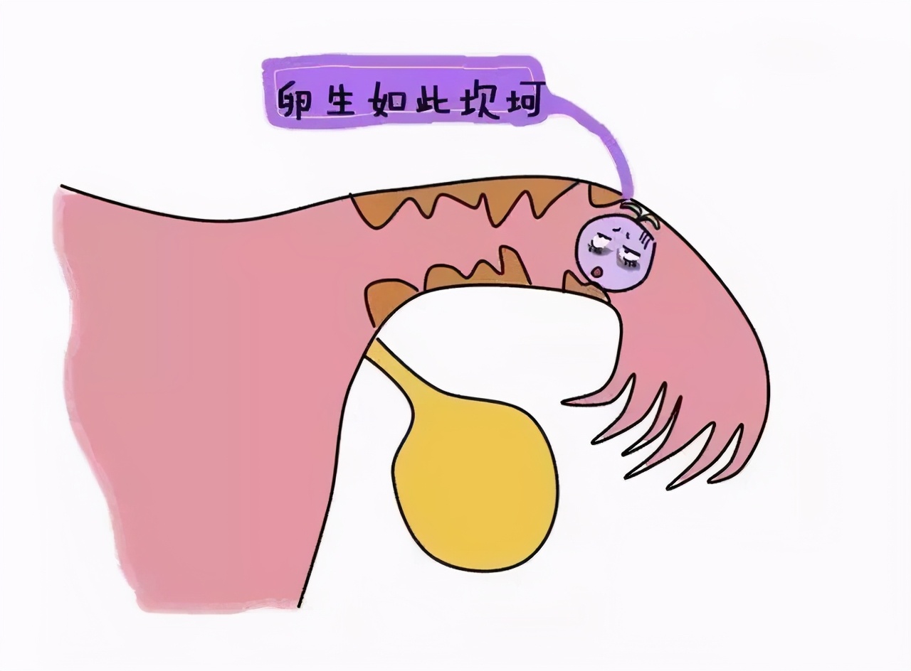 只剩一侧输卵管如何检测排卵,输卵管切除一侧怎么监测排卵