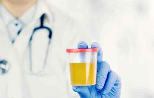 老人长期口干舌燥怎么办,老年人经常口干喝什么中药调理