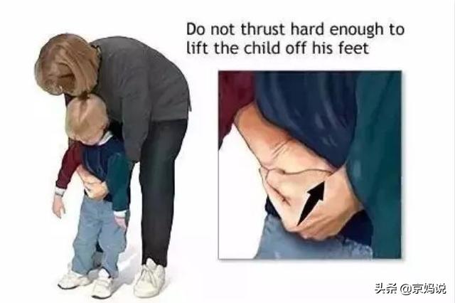 异物卡喉海姆立克急救法视频,异物卡喉用海姆立克急救法